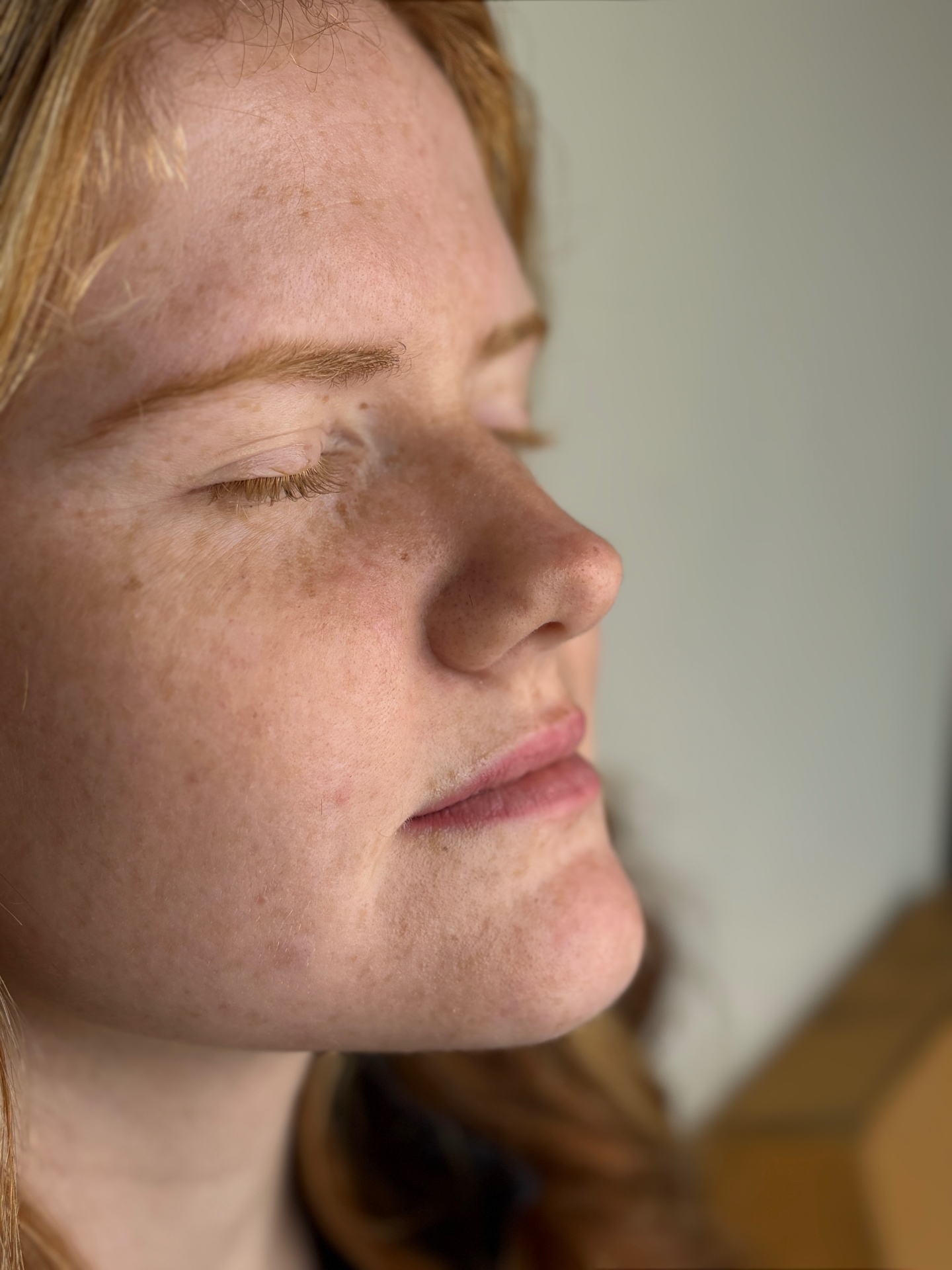 Client lip blush result — right profile