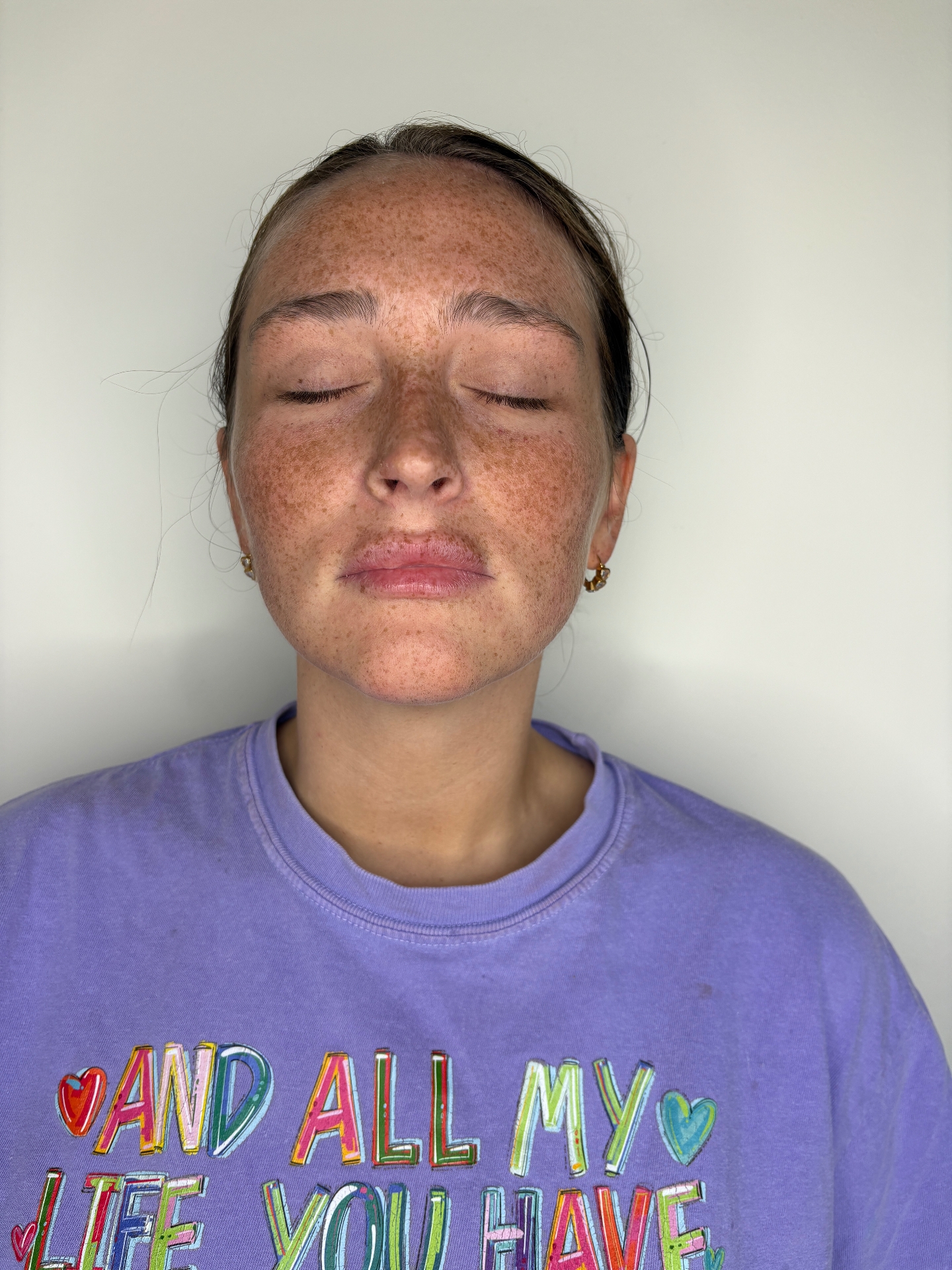 Client front view before powder brows
